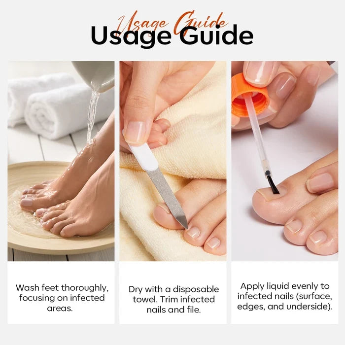 Nail Antifungal Treatment