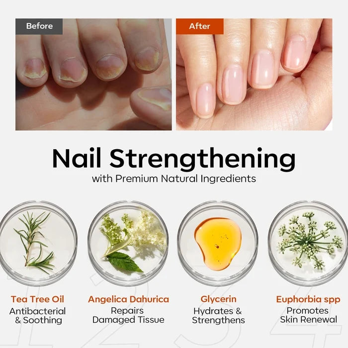 Nail Antifungal Treatment